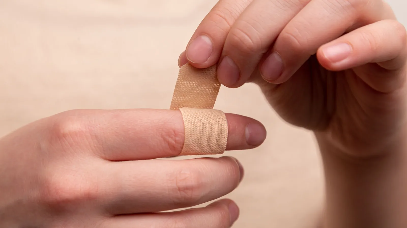 Bruise after a blood draw: why it happens and what helps