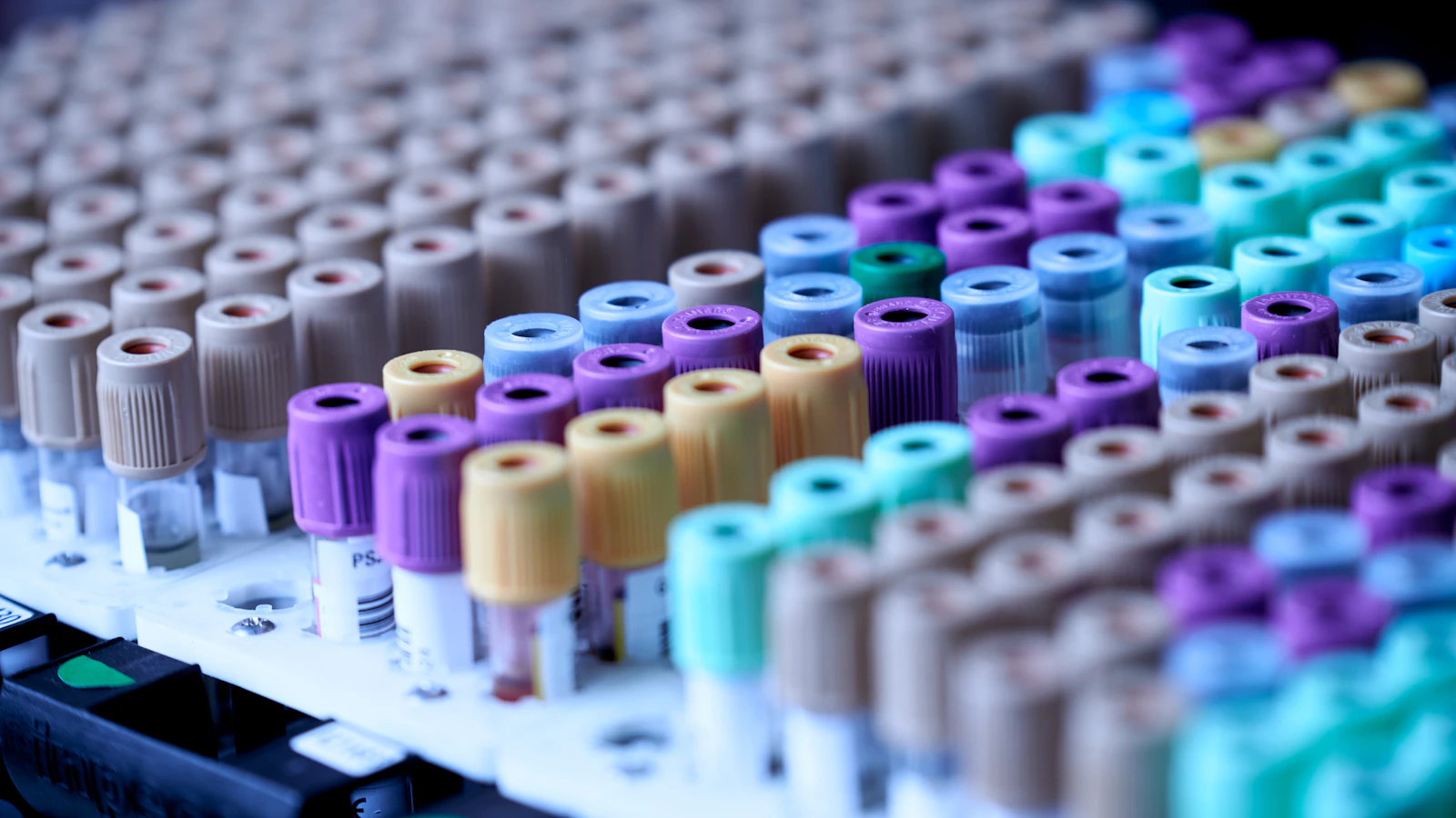 Rek met gekleurde bloedbuisjes in een laboratorium
