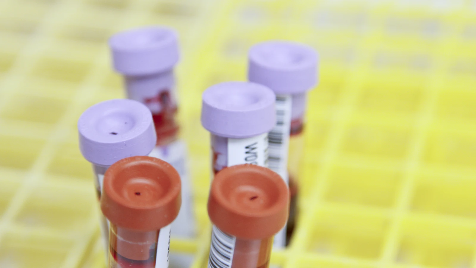 Blood tubes with purple and red caps in a yellow rack
