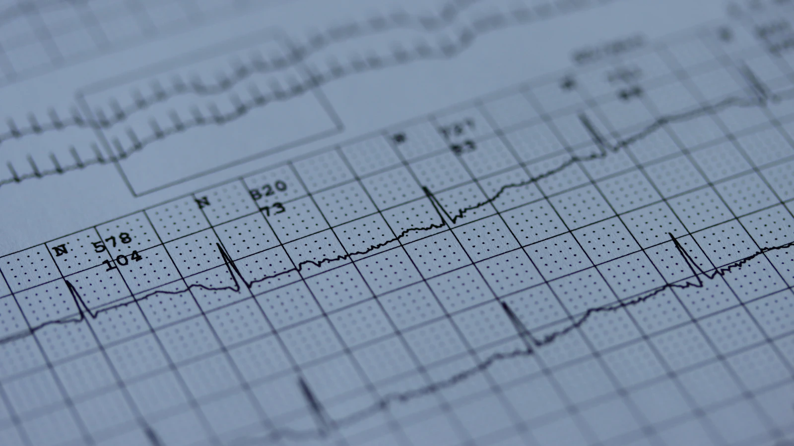 Close-up van een ECG-uitdraai op papier met hartritmecurves.
