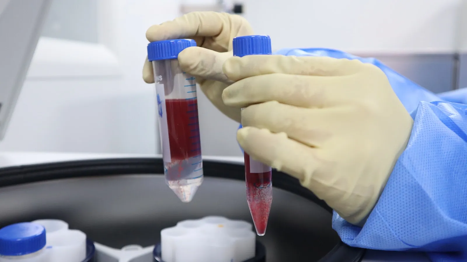 Een gehandschoende hand houdt een buisje met bloed vast in een laboratorium.