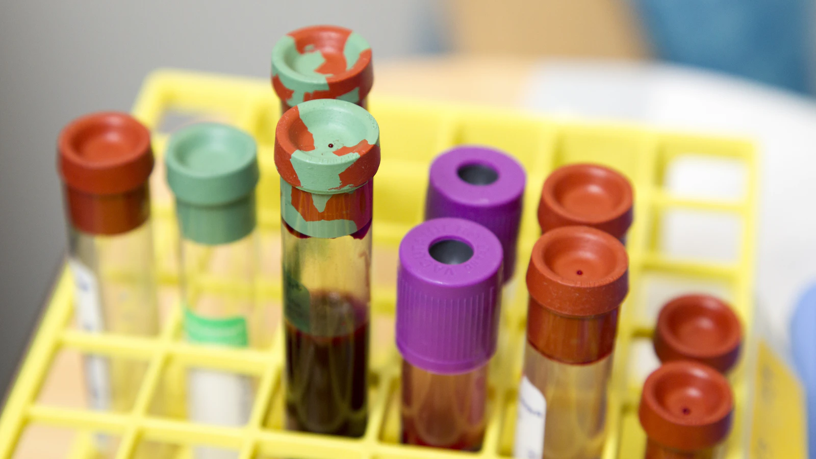 Glazen reageerbuizen op een rek in een laboratorium.