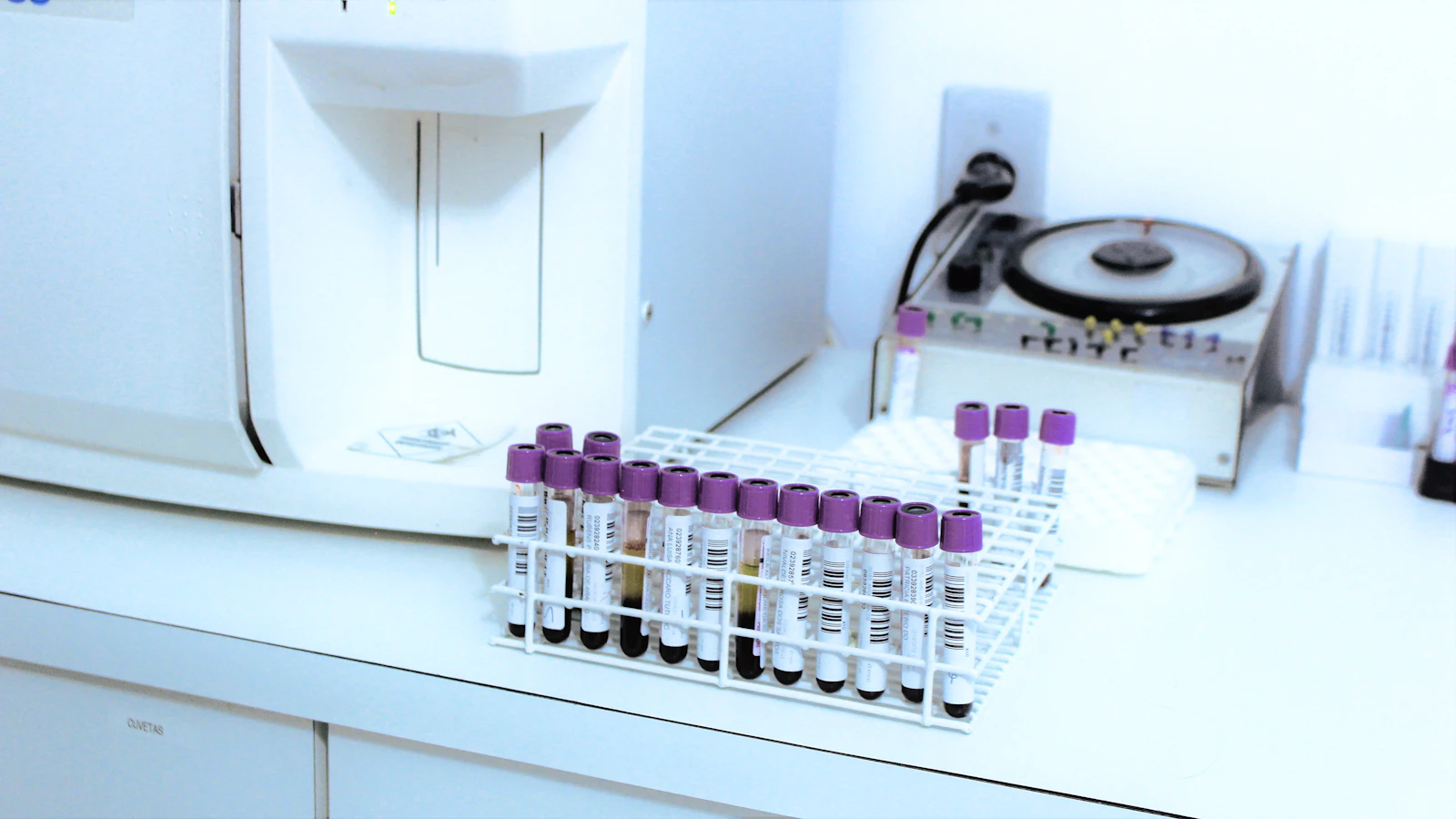 Laboratoriumapparaat met buisjes voor bloedonderzoek.