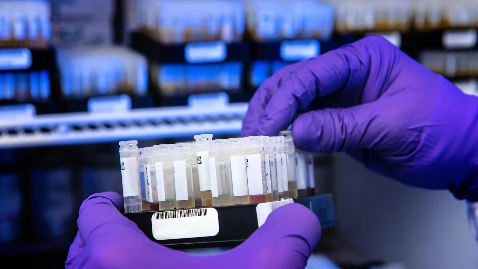 Een medewerker in een laboratorium bekijkt buisjes met bloedmonsters.