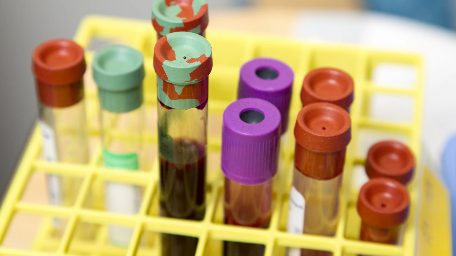 Glazen buisjes in een laboratorium voor bloedonderzoek.
